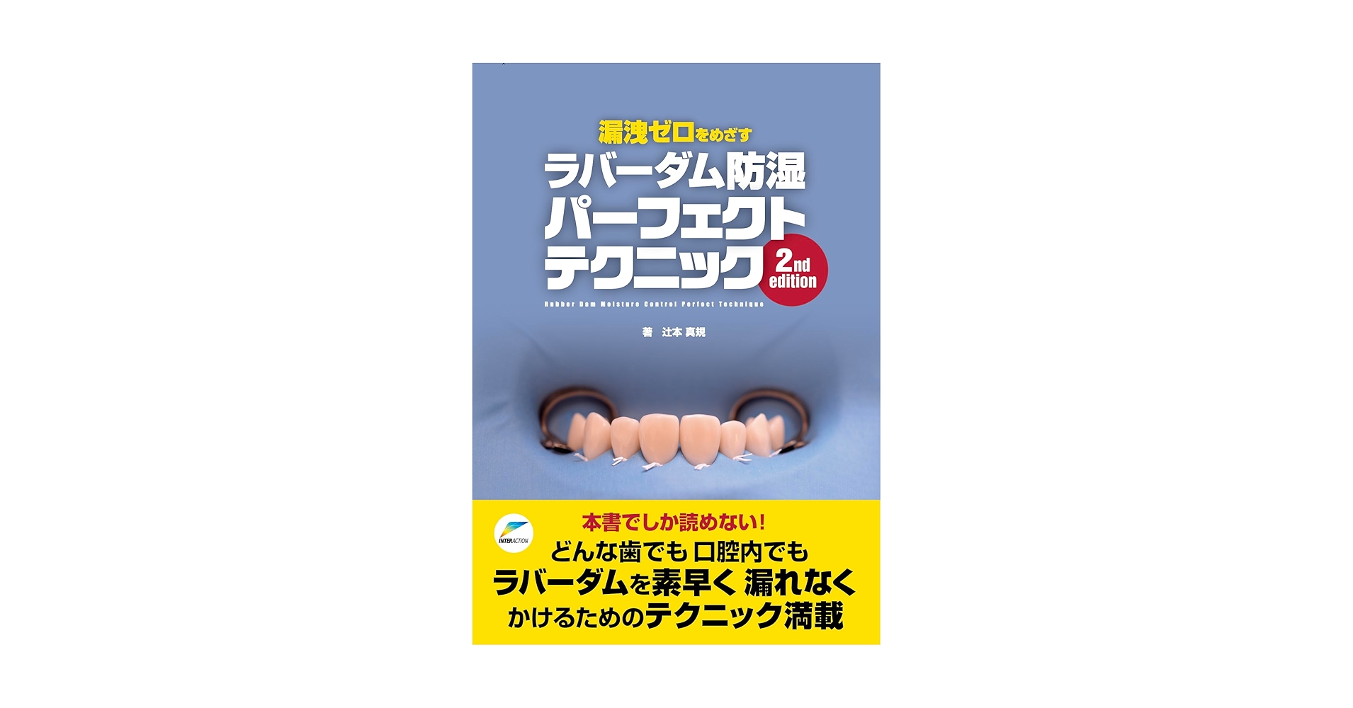 漏洩ゼロをめざすラバーダム防湿パーフェクトテクニック 漏洩ゼロをめざすラバーダム防湿パーフェクトテクニック | 辻本